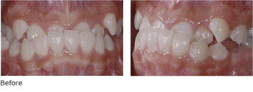 Case 2