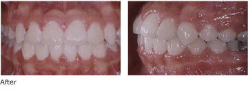 Case 2